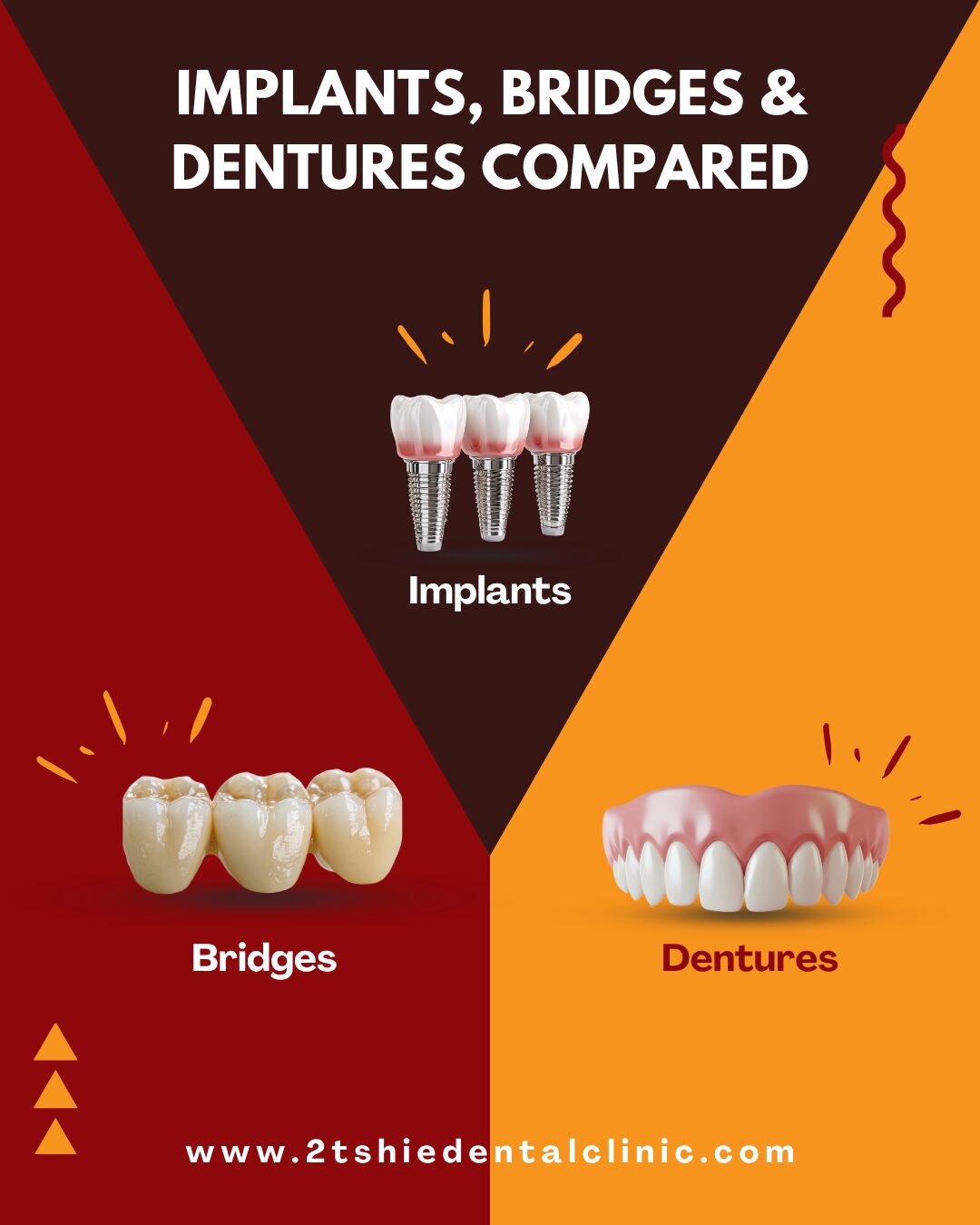 Implants, dentures and bridges compared