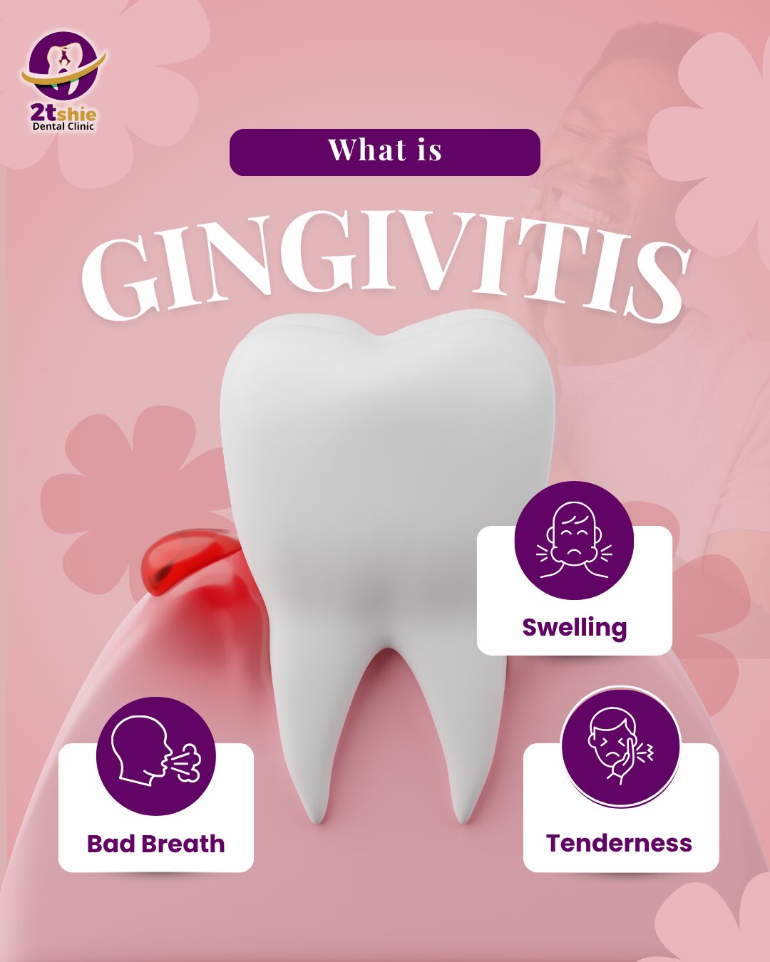 2tshie - What is Gingivitis